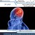 تومور مغز 🧠 از علت تا درمان + دکتر شمس