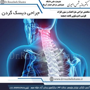 جراحی دیسک گردن - دکتر شمس
