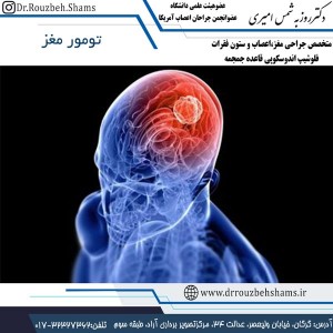 تومور مغز - دکتر شمس