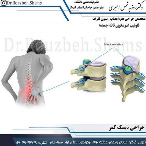 جراحی دیسک کمر - دکتر روزبه شمس