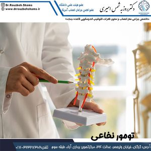 تومورهای نخاعی - دکتر شمس