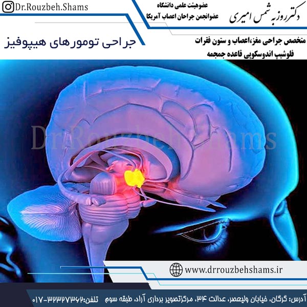 جراحی تومورهای هیپوفیز