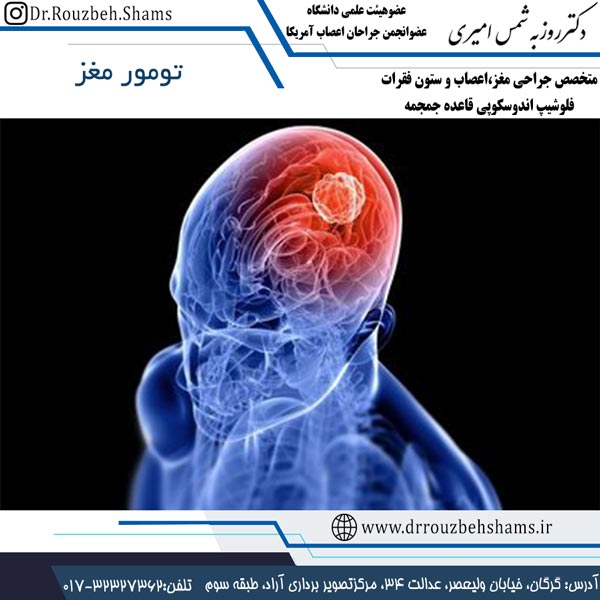 تومور مغز
