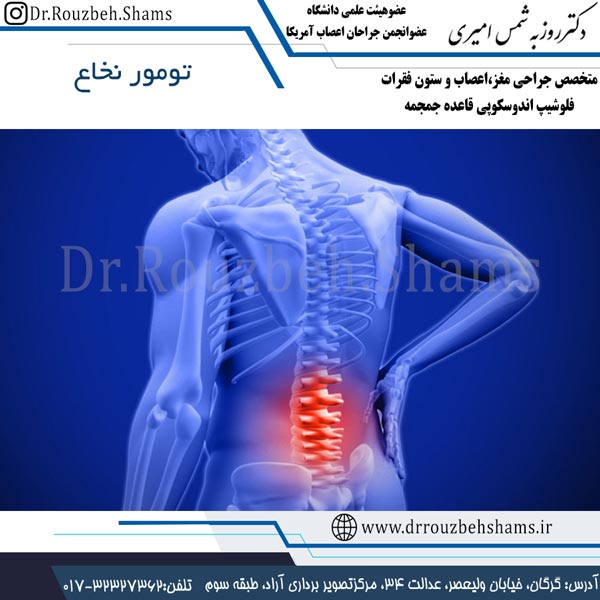 تومور نخاع