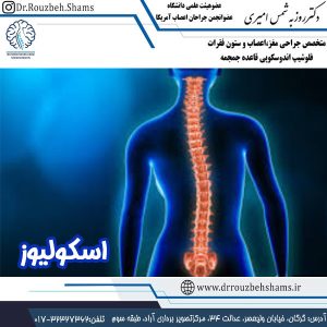 اسکولیوز - دکتر روزبه شمس - drrouzbehshams.ir
