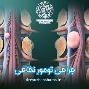 جراحی تومور نخاعی