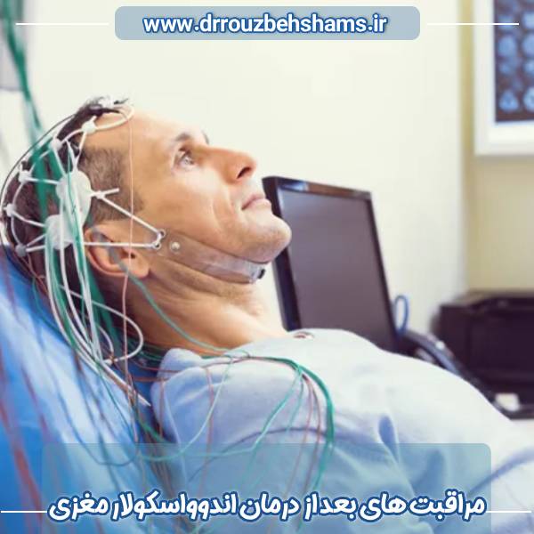 مراقبت‌ های بعد از درمان اندوواسکولار مغزی